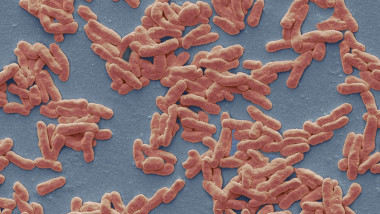 De câte feluri este boala, cum se manifestă şi cum se tratează