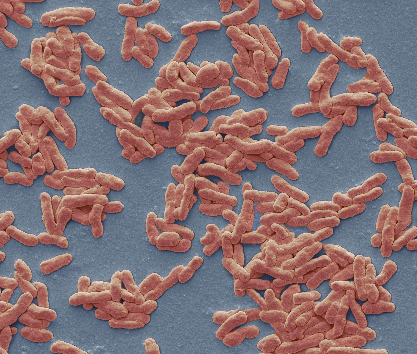 Caz de lepră în România: De câte feluri este boala, cum se manifestă şi cum se tratează. Explicațiile unui medic