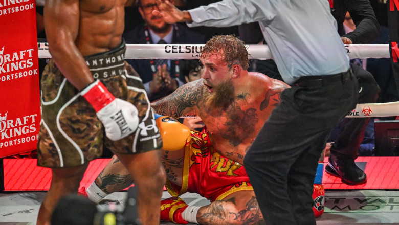 Jake Paul, învins prin KO într-un meci de box cu Anthony Joshua, are două fracturi la maxilar: i s-au implantat plăci de titan