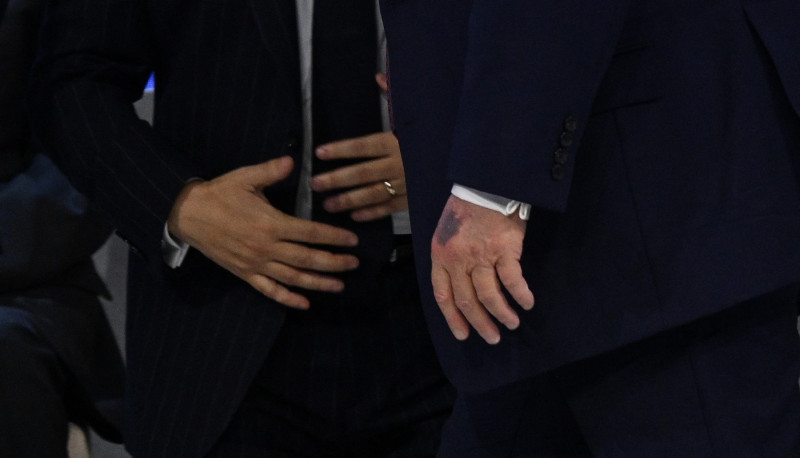 Donald Trump a fost supus celui de-al treilea control medical în 13 luni: ce a declarat președintele SUA care face 80 de ani în iunie 3 Donald Trump mana vanataie profimedia-1068424626