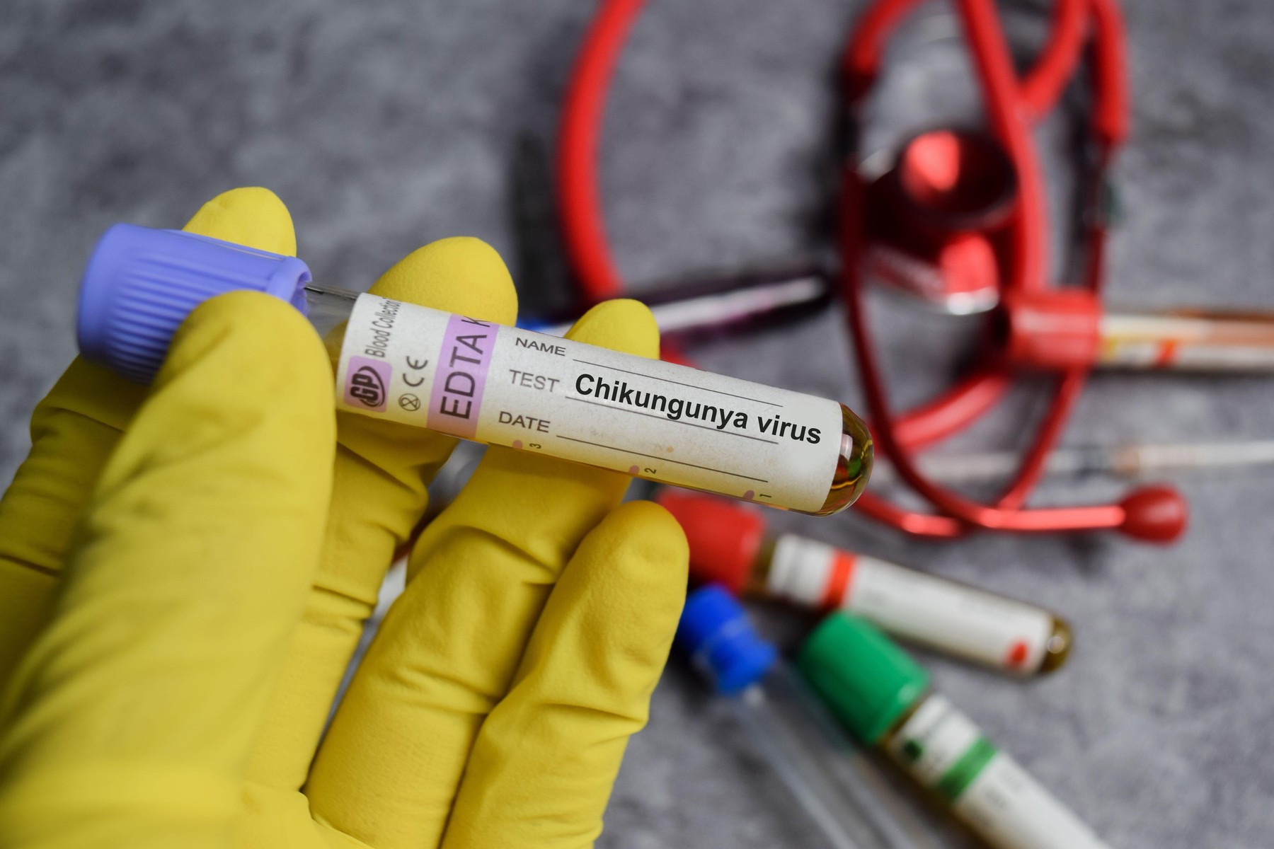 Alertă în România: primul caz de virus Chikungunya confirmat la un bărbat venit din Africa