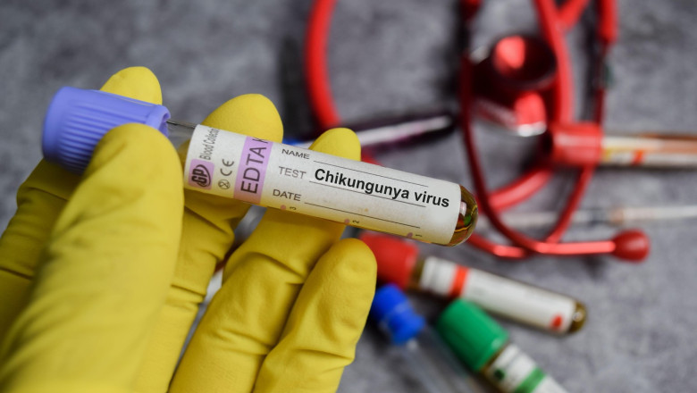 Chikungunya virus vaccination drug in yellow gloved hands. Medical concept