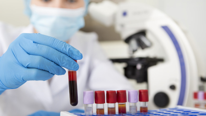 Intoxicație cu metale grele. Foto Getty Images