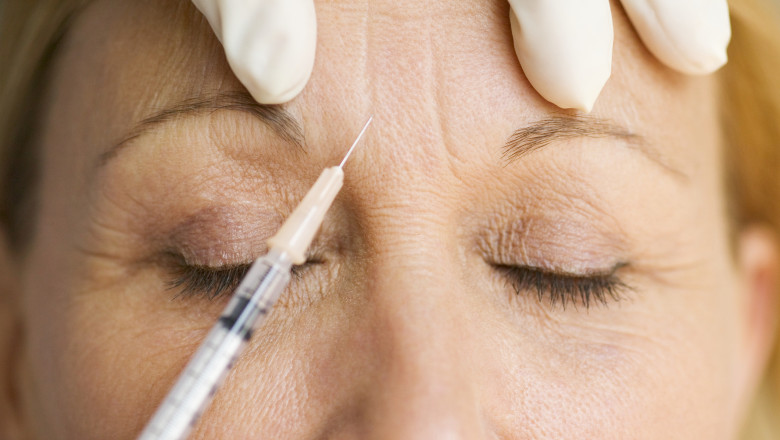 botox