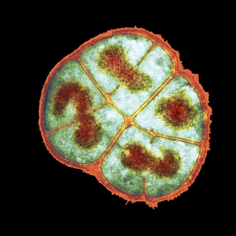 Radiation resistant bacteria, SEM