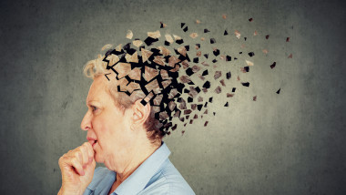 Senior woman losing parts of head feeling confused as symbol of decreased mind function.