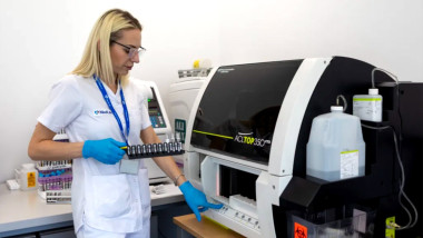 Inovație în medicina de laborator - test cancer pulmonar