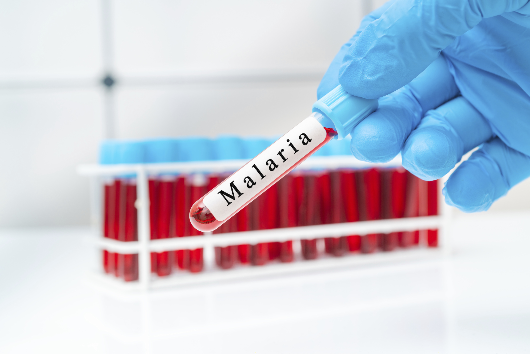 Trei cazuri suspecte de malarie la copii, după o călătorie în Africa. Anunțul ministrului Sănătății