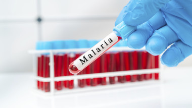 Malaria blood test, conceptual image