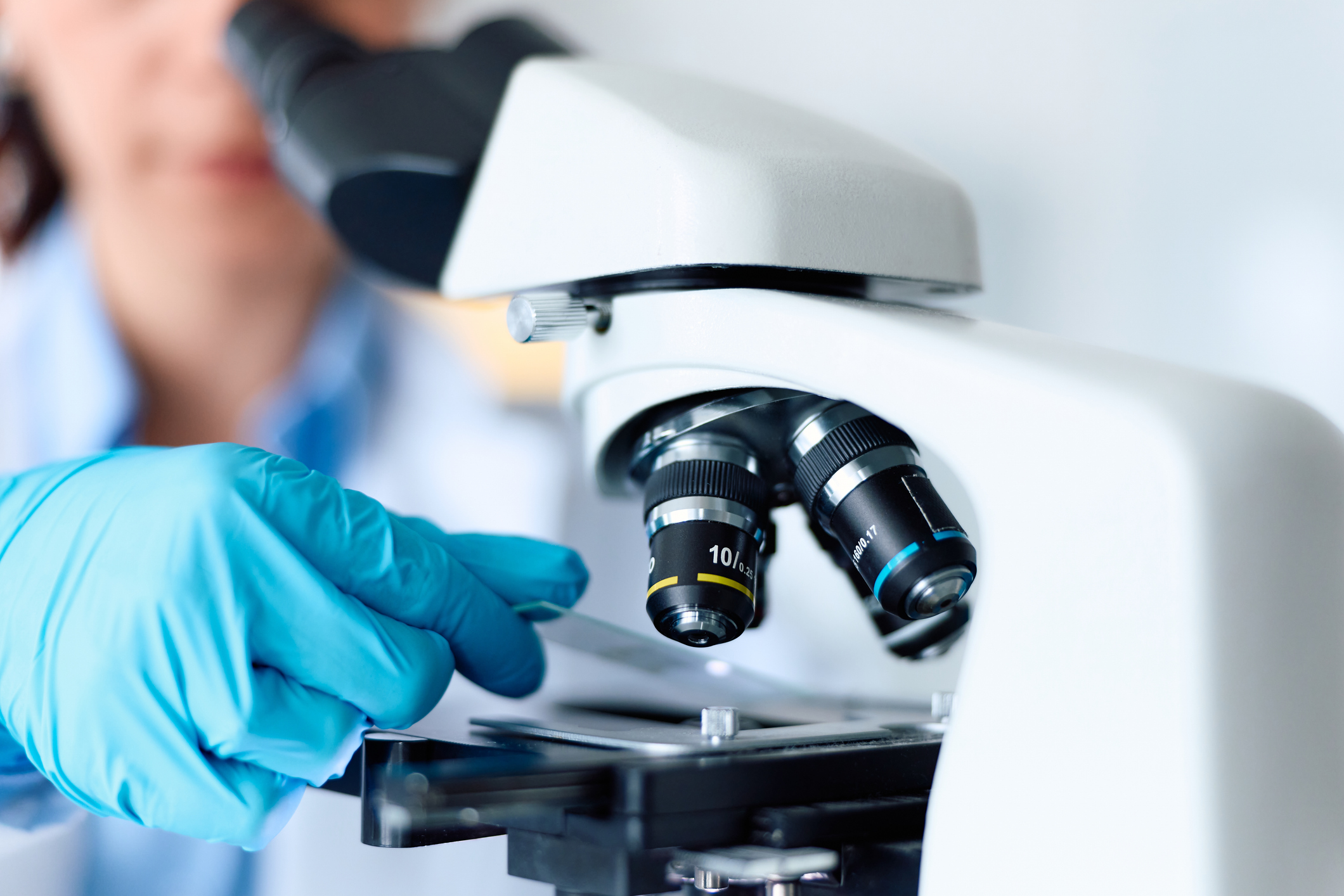 Descoperire în interiorul celulelor nervoase: indiciul care ar putea schimba tratamentele pentru Parkinson