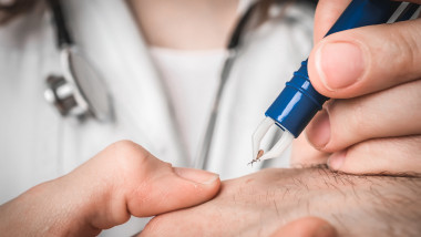 Boli infecțioase transmise de căpușe. Foto Getty Images