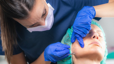 injectare subdermică de filler dermic operatii estetice medic pacient