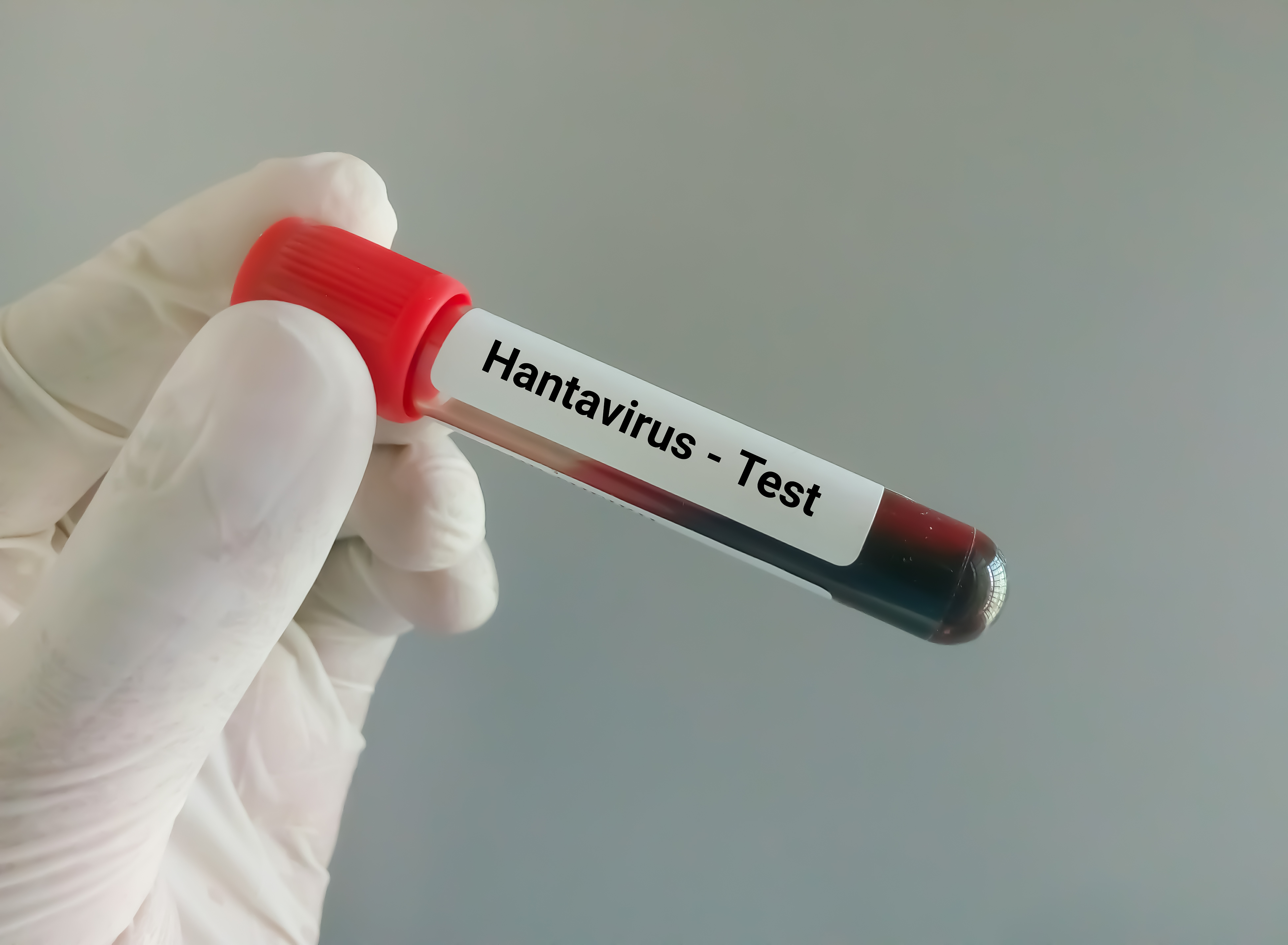 Ce este hantavirusul, infecția care a provocat trei decese pe o navă de croazieră. Medicii explică ce riscuri există în România