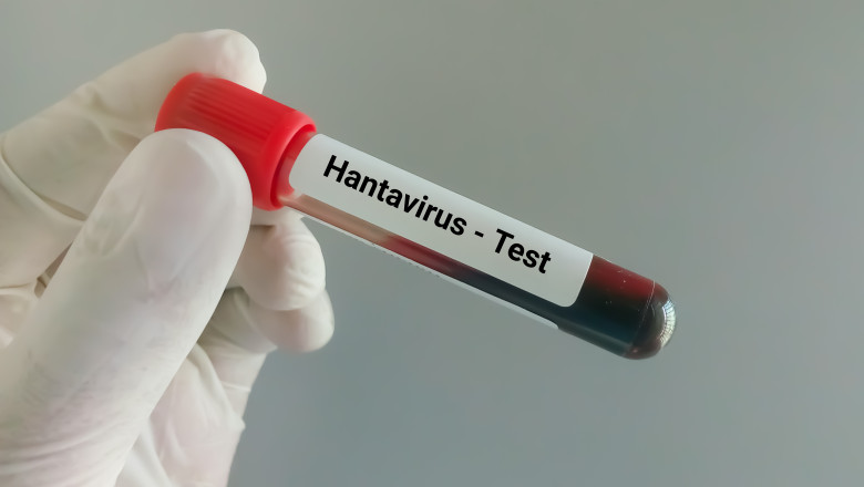 Tânărul din Arad suspect de hantavirus a fost confirmat pozitiv. Ce spun autoritățile despre tulpina virusului