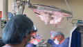 Transplant hepatic rar în România. Intervenția-maraton a salvat o fetiță de un an și jumătate