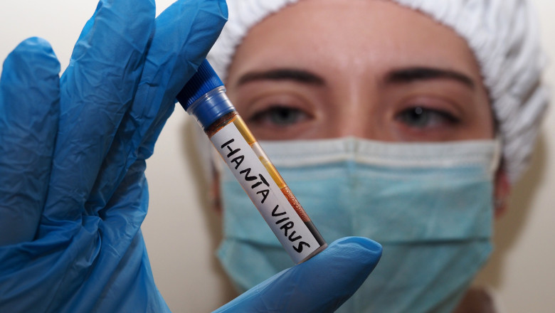 Italy: Illustration Hantavirus