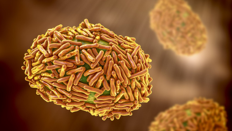 variola maimutei mpox