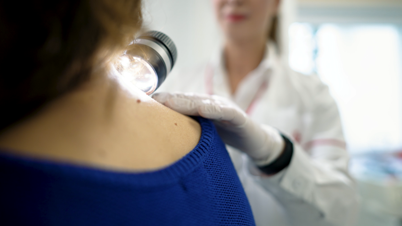 Primul centru multidisciplinar integrat pentru tratarea melanomului s-a deschis în cadrul Spitalului Euroclinic