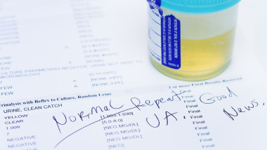 Studio shot of urine sample on test printout showing normal results. Testing is done as part of yearly health checkup