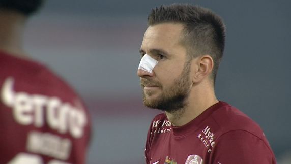L-a umplut de sânge! Cum arată Alex Păun, după ce a fost lovit în plină figură de Ovidiu Bic