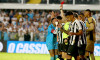 BRAZILIAN 2025, SANTOS x BOTAFOGO