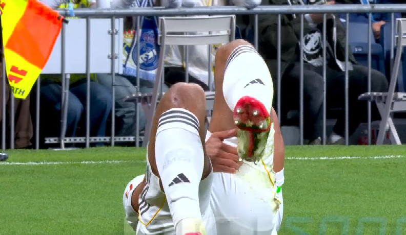 Imagine Stire OUT! Starul de 160.000.000 € al lui Real Madrid s-a ”rupt” în minutul 9 | 2review.ro