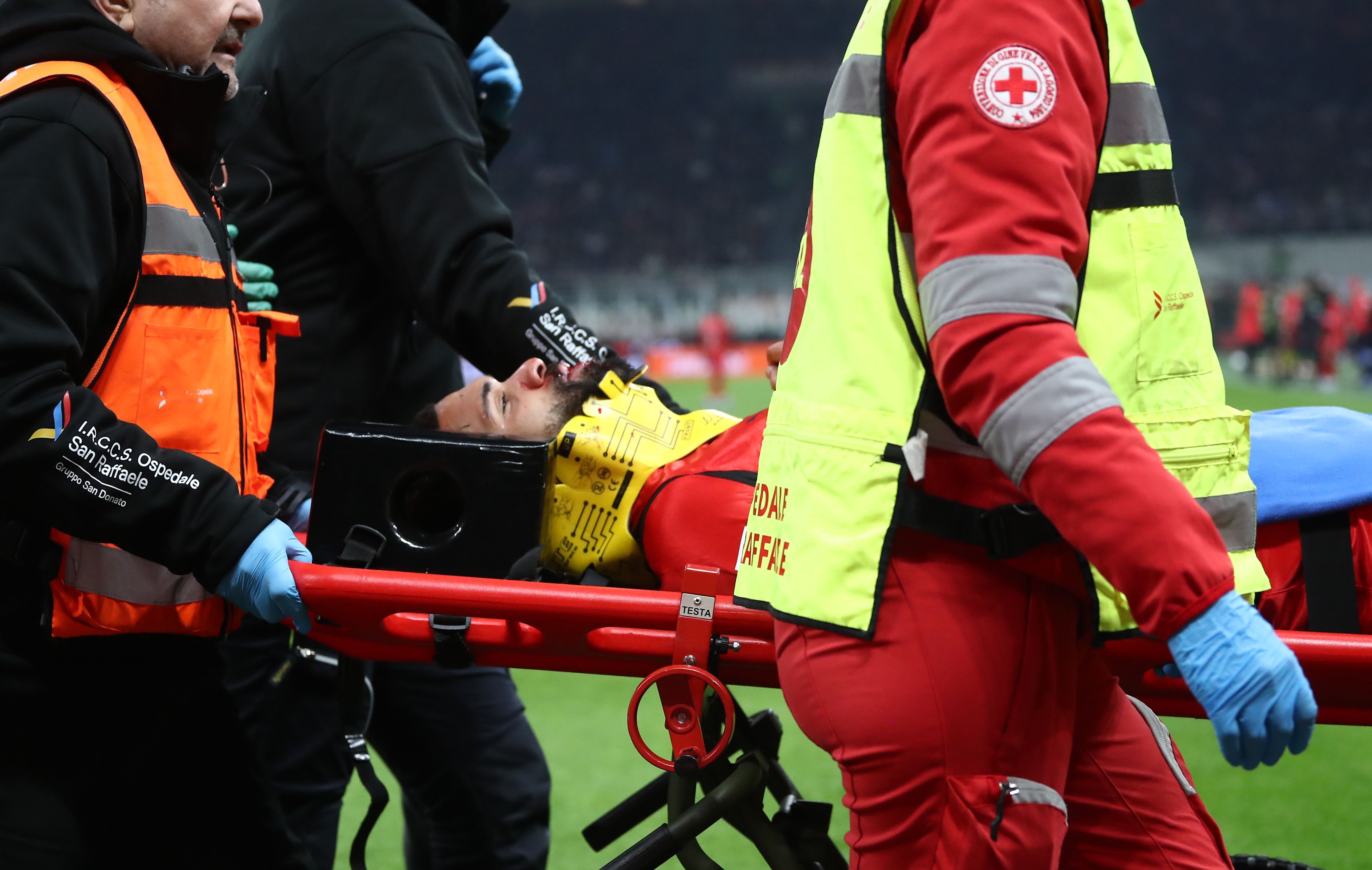 Imagine Stire Mesajul milanezului care a suferit o accidentare horror, în care și-a pierdut mai mulți dinți | 2review.ro