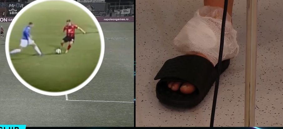 Doicaru a apărut cu glezna umflată la interviu, după controversa din Csikszereda - Farul! Ce i-a spus arbitrul