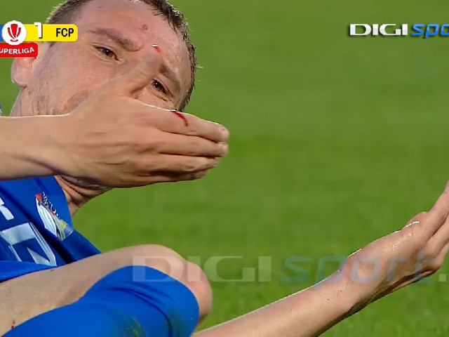 Poza pentru articolul Controversă la Slobozia - Petrolul! I-a ”spart” fața, dar a scăpat de eliminare: ”Poate vom afla și explicațiile”