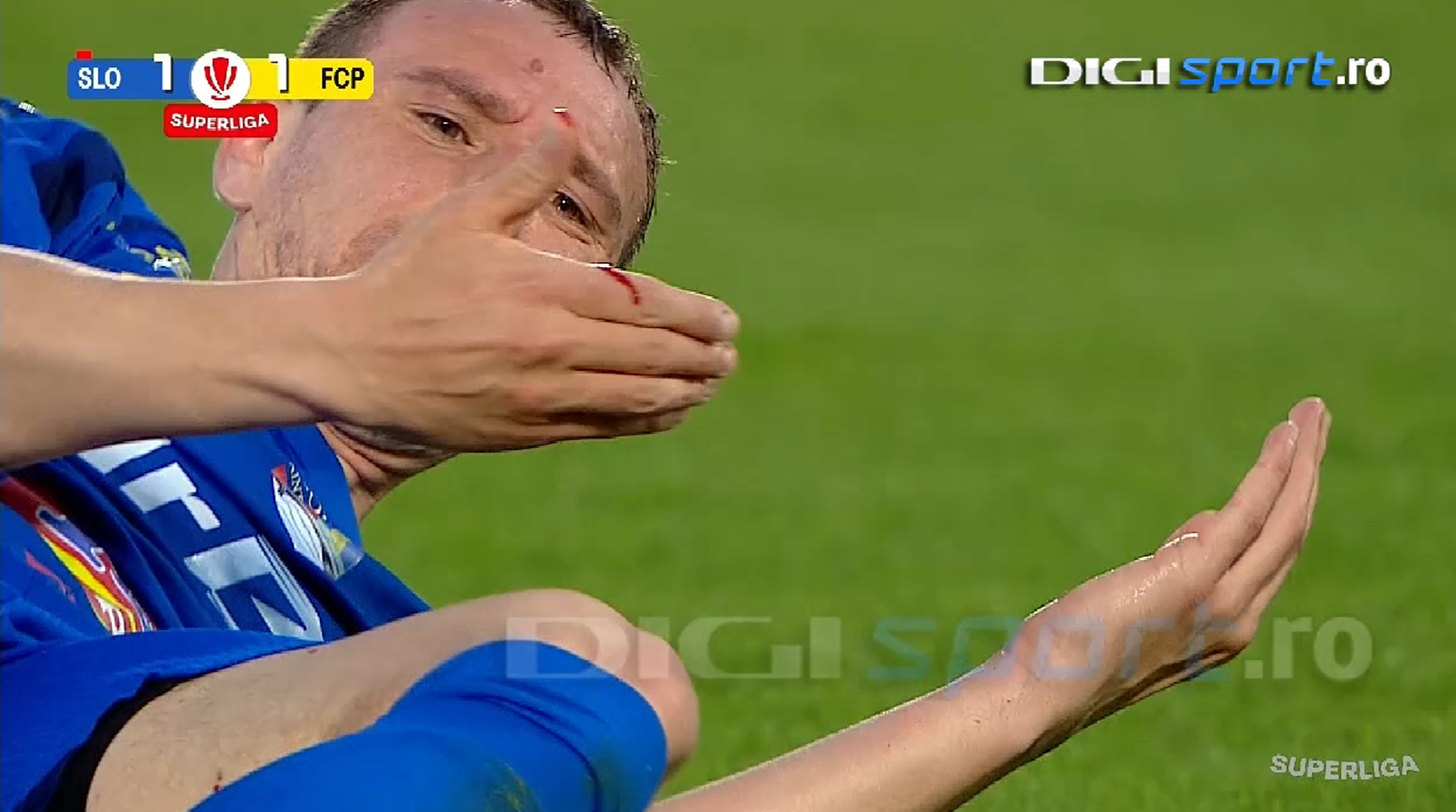 Imagine Stire Controversă la Slobozia - Petrolul! I-a ”spart” fața, dar a scăpat de eliminare: ”Poate vom afla și explicațiile” | 2review.ro