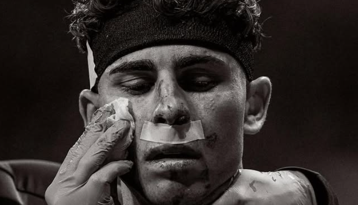 Cum a apărut Fermin Lopez, la 4 zile după ce a fost desfigurat în Atletico - Barcelona