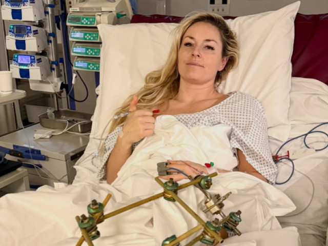 Lindsey Vonn, după opt operații în trei luni