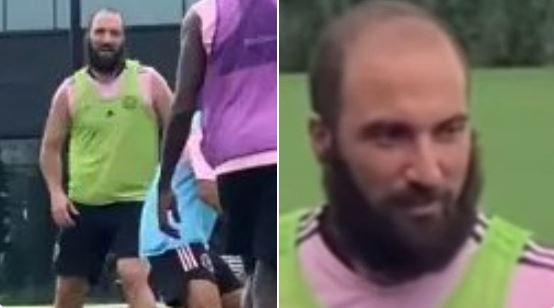 Gonzalo Higuain, de nerecunoscut la noua echipă și cu "noul gabarit". A ajuns mai ieftin decât Dennis Man
