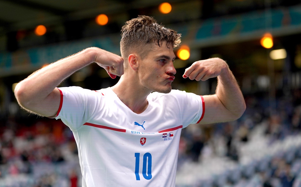 Războinicul Patrik Schick! Cu nasul spart, a transformat un penalty și e golgheterul EURO 2020. Cum arată TOPUL