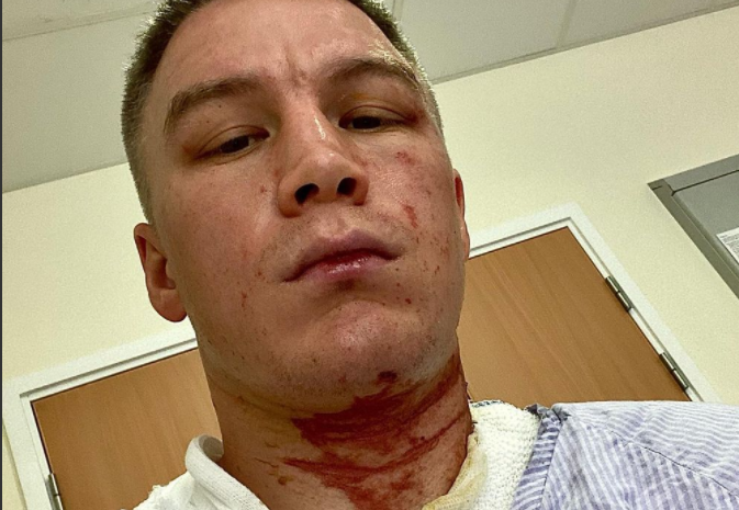 Brutal. Cum arată un boxer profesionist după ce a fost atacat cu acid + cum s-a produs, pas cu pas, asaltul