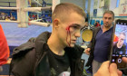 Gabriel Șchiopu, după ce a fost lovit / Foto: Facebook@Șchiopu Gabriel