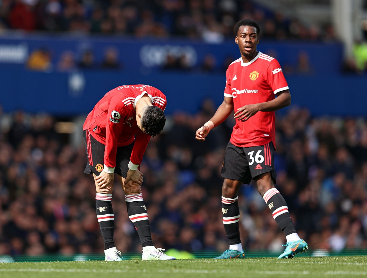 Cum arăta piciorul lui Cristiano Ronaldo, la finalul partidei Everton - Manchester United 1-0