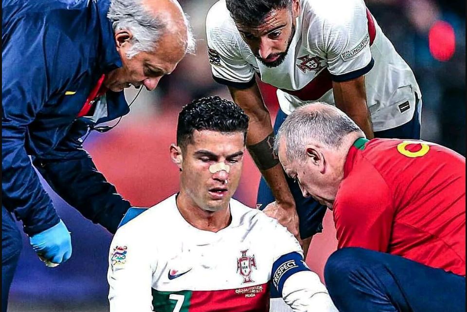 Portughezii au clarificat situația lui Cristiano Ronaldo, accidentat la nas în meciul cu Cehia