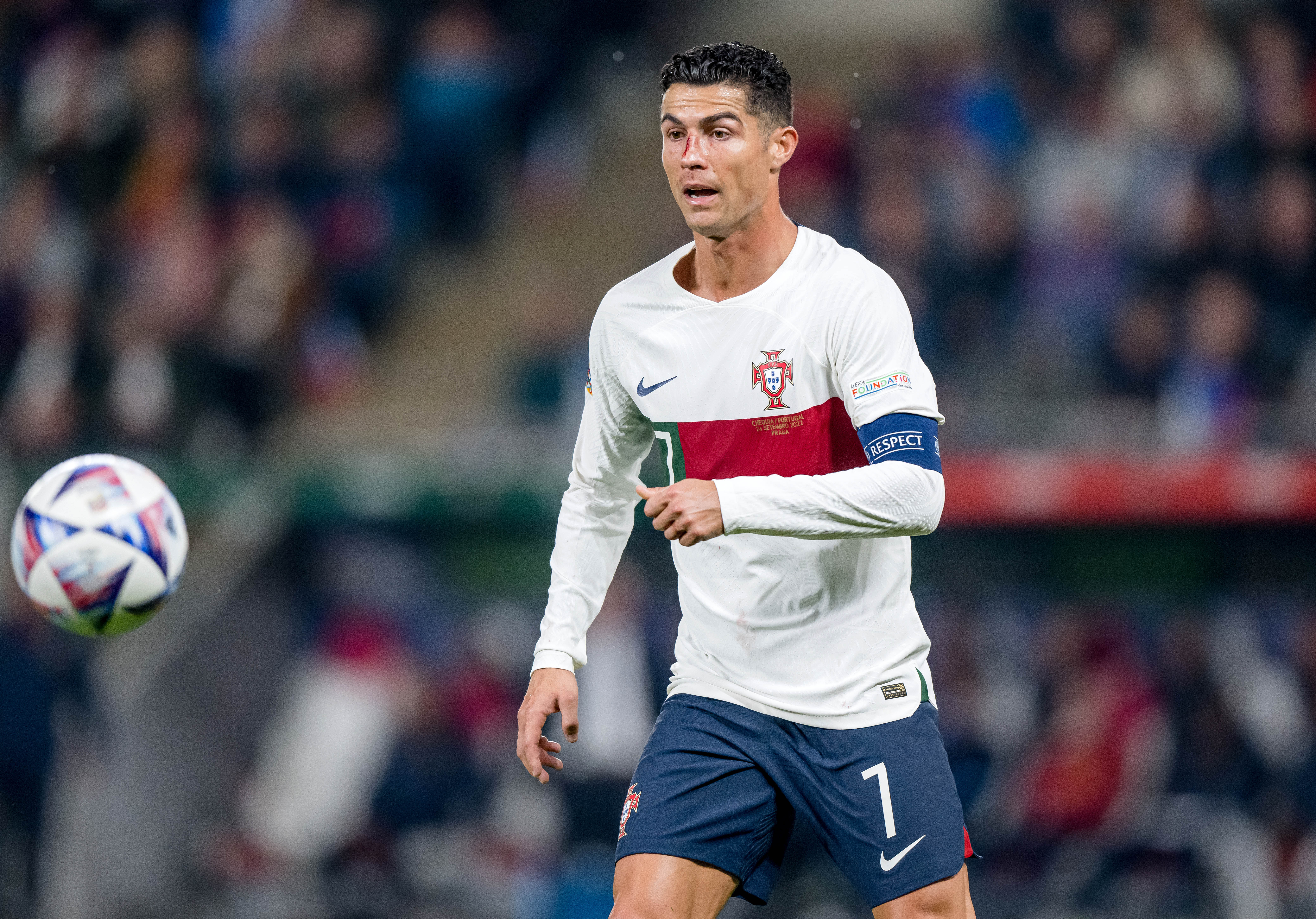 Cum a apărut Cristiano Ronaldo la antrenament, după ce a fost umplut de sânge la meciul Cehia - Portugalia