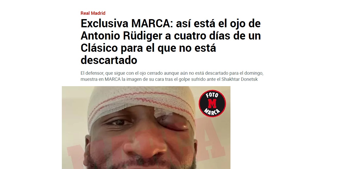Cum arată Rudiger după accidentarea horror din Sahtior - Real Madrid. Prezența în El Clasico sub semnul întrebării