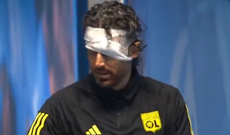 Cum arată acum Fabio Grosso, după ce a fost umplut de sânge de fanii lui Marseille