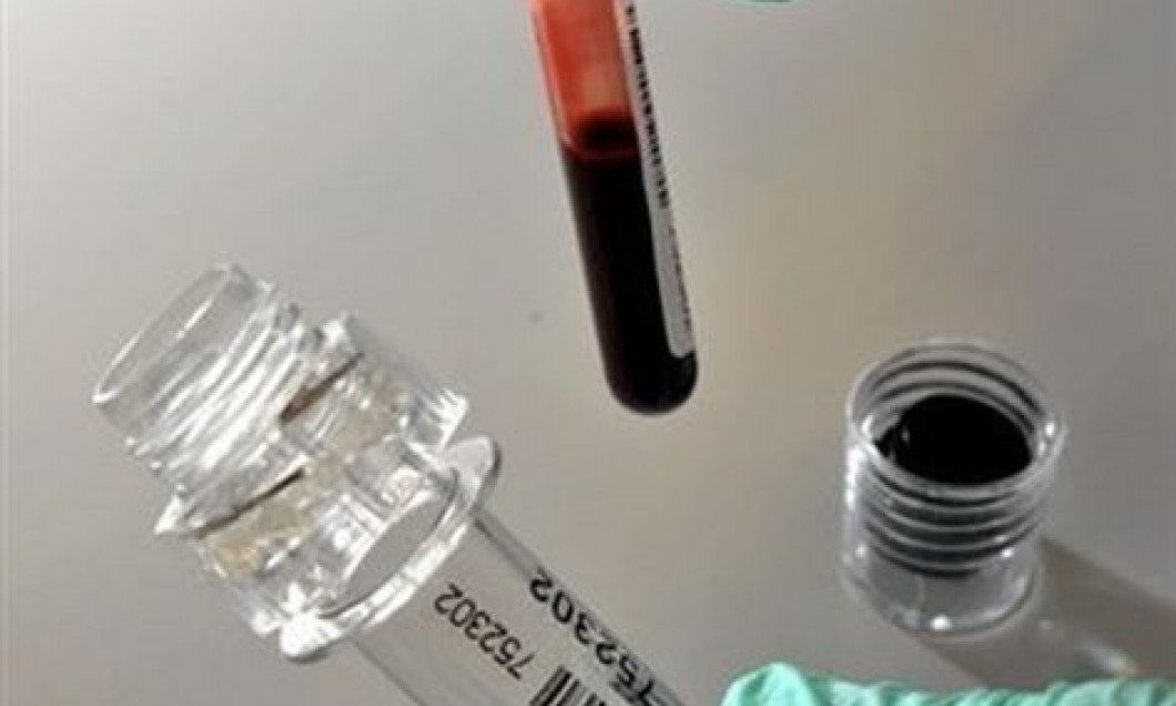 analize sange