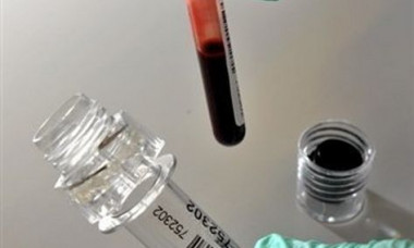 analize sange