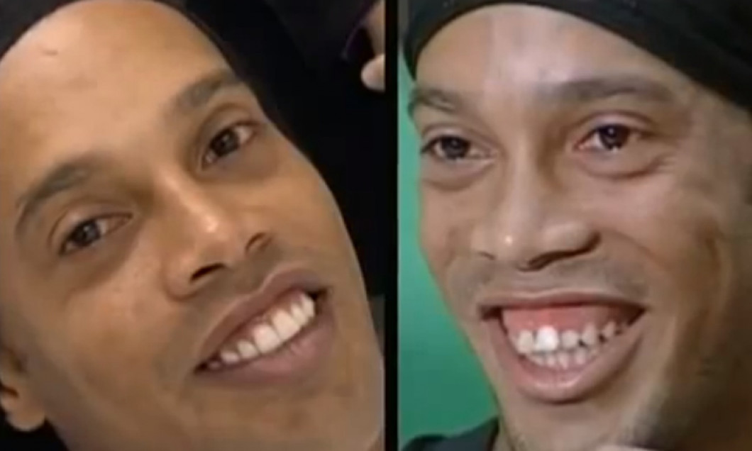 dintii lui ronaldinho