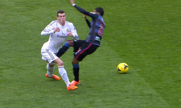 bale accidentare