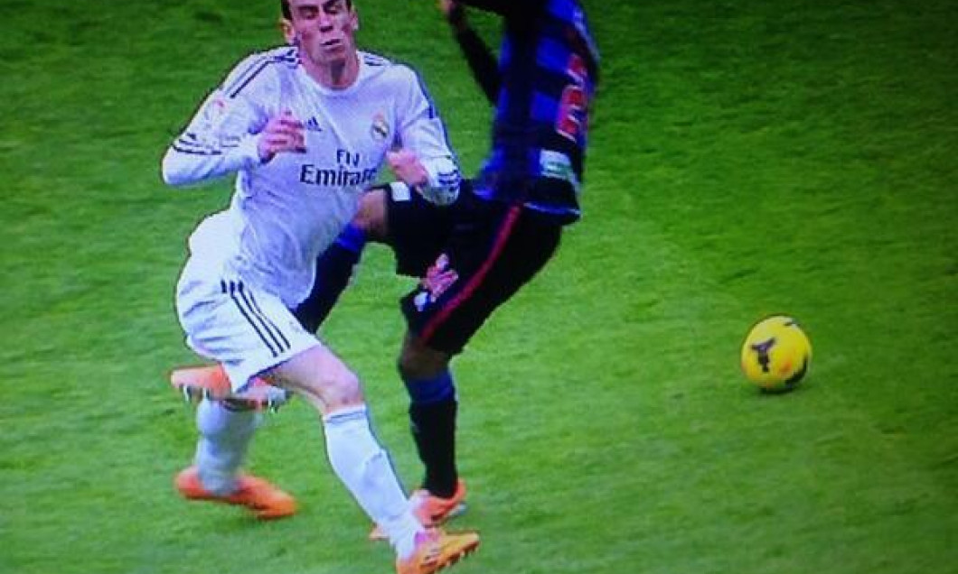 bale accidentare