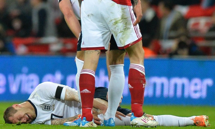 jack wilshere fractura