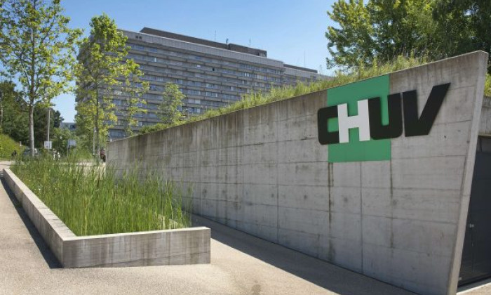 chuv lausanne