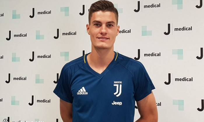 schick juventus