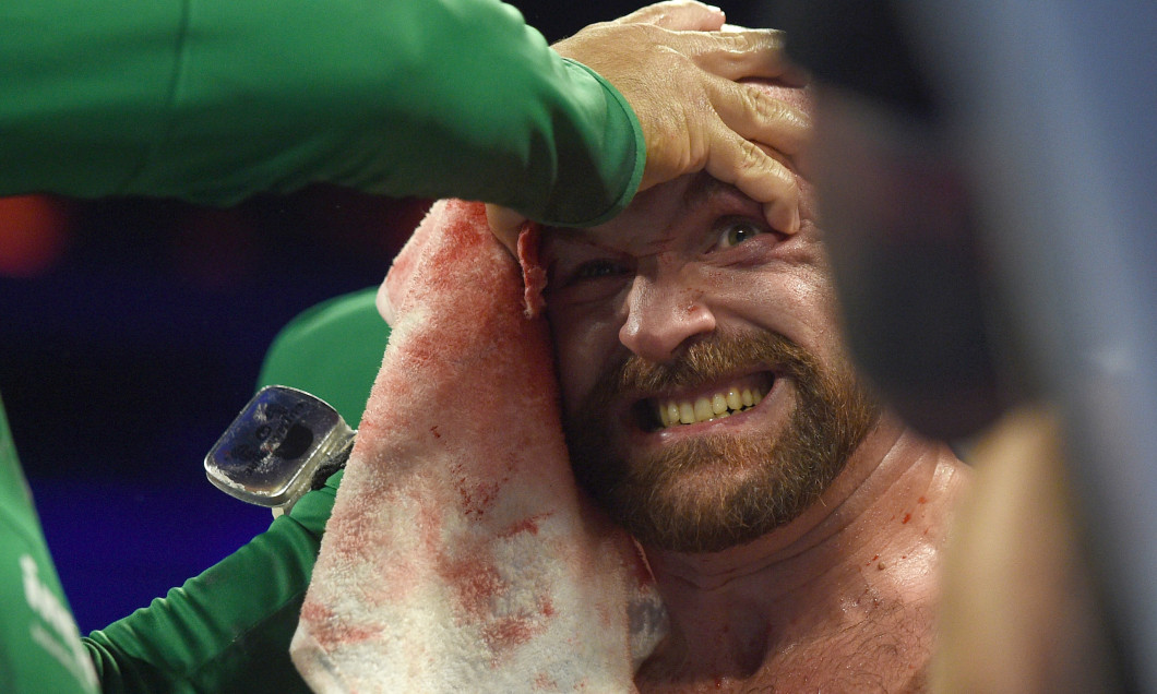 Tyson Fury v Otto Wallin
